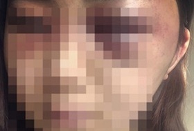 광주 데이트 폭행 가해 남성, 여친에게 썸뜩한 말 "평생 넌 내 장난감"